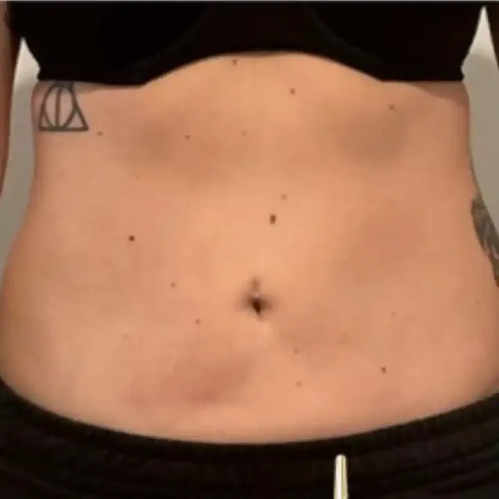 After stomach and flanks, front