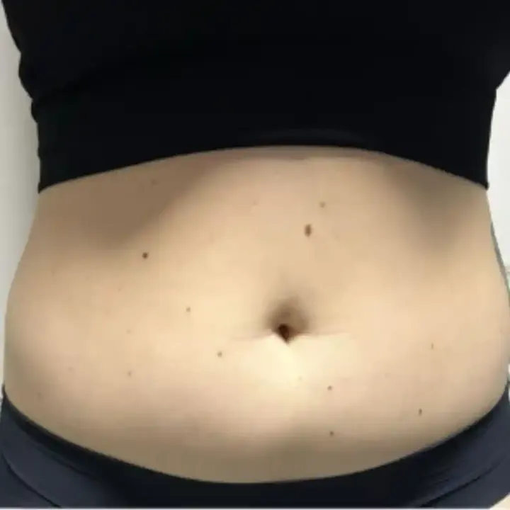 Before stomach and flanks, front