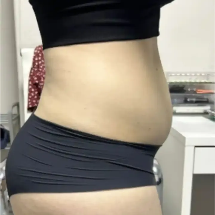 Before stomach and flanks, side